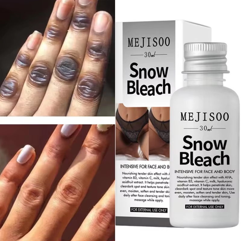 Skincare Korea - Fast Whitening Dark Knuckles Brighten Hand