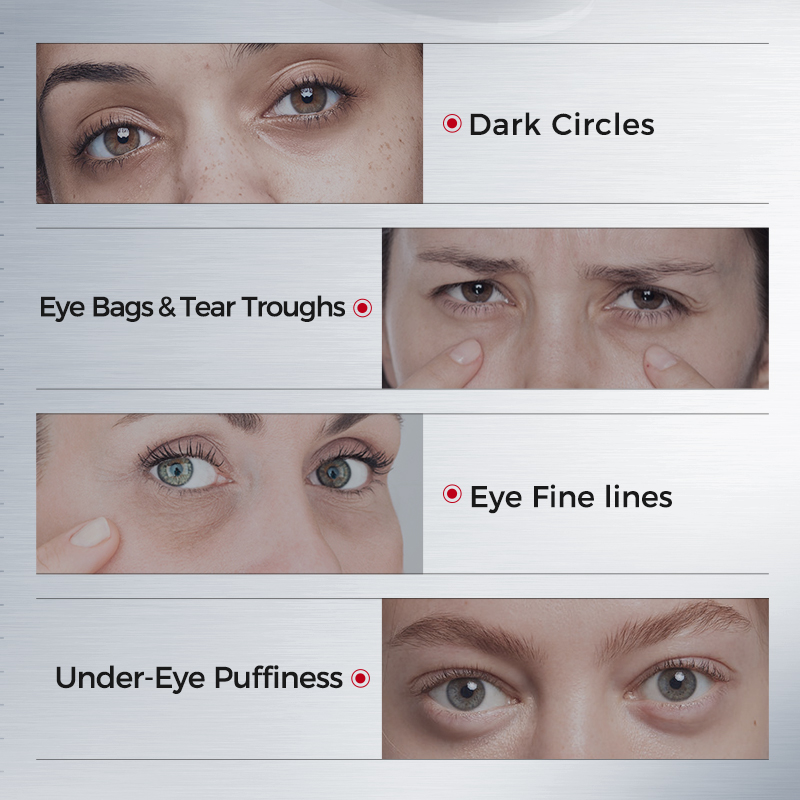 Eye Patches for Dark Circles – - Collagen Sheet Mask review and price