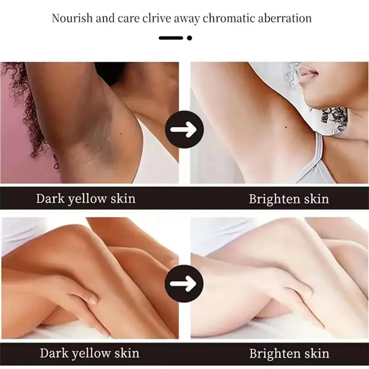 Fast Whitening Dark Knuckles B - Skincare Korea review and price