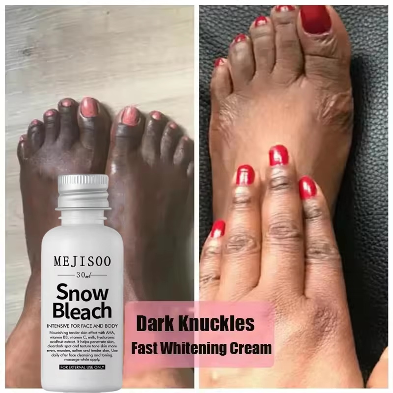 Fast Whitening Dark Knuckles B - Skincare Korea review and price