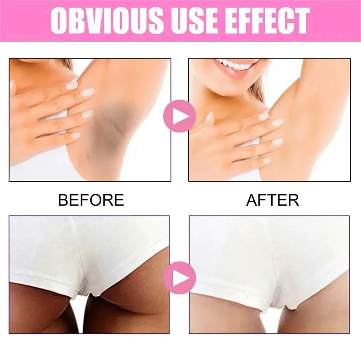 Fast Whitening Dark Knuckles B - Skincare Korea review and price