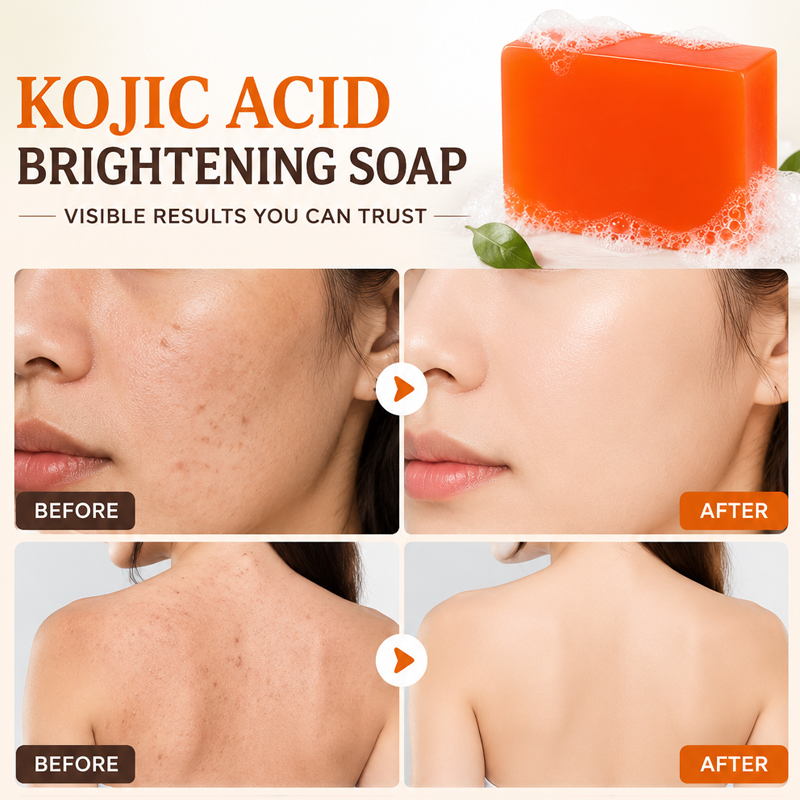 Kojic Acid Soap 6 Pack Brighte - Kojic Acid Soap review and price