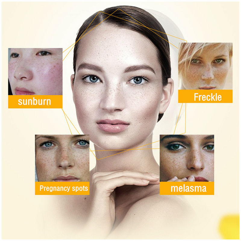Dimollaure Whitening Freckle C - Skincare Korea review and price