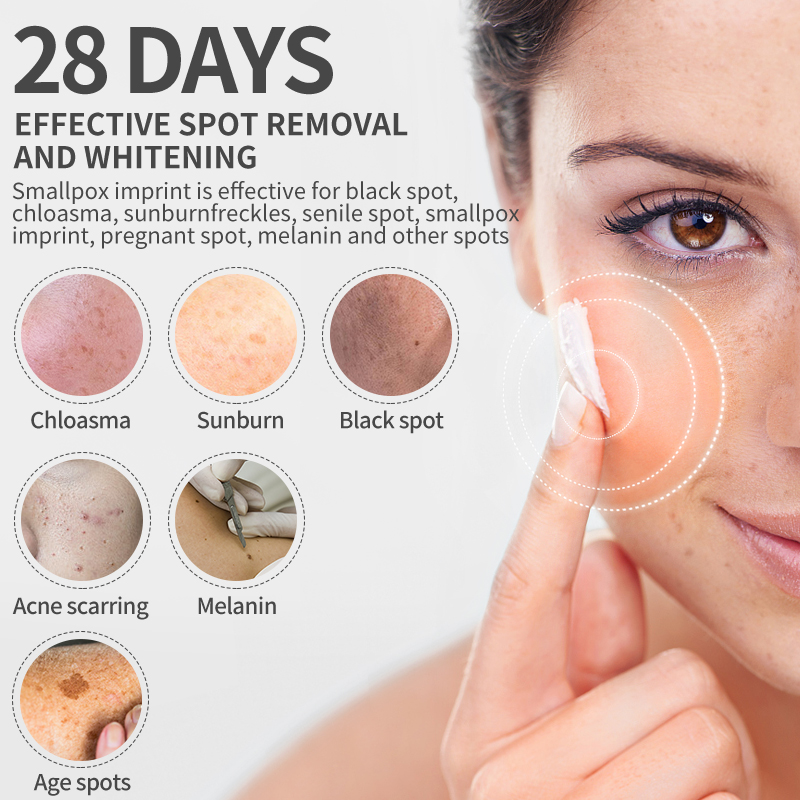 Dimollaure Whitening Freckle C - Skincare Korea review and price